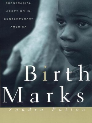 cover image of Birthmarks